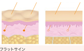 フラットサイン